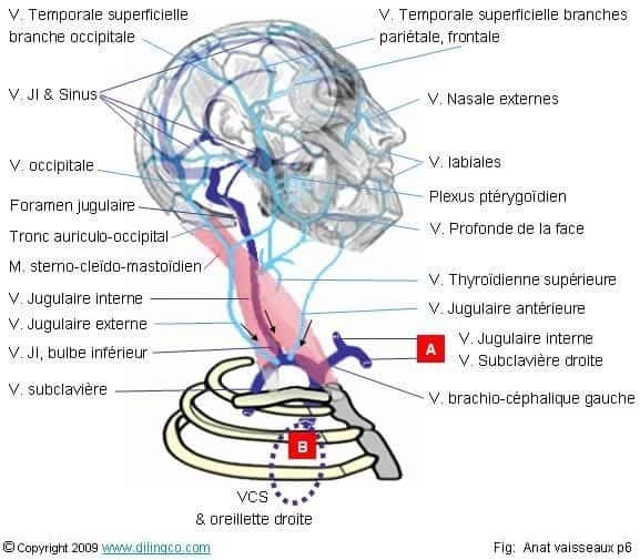 Anatomie du nerf vague et placement de l'électrode bipolaire de